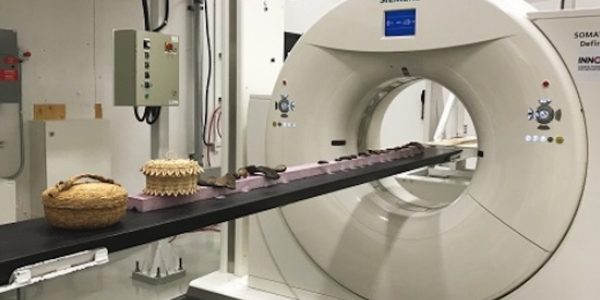 Tomographie et transformée de Radon : des images de maths !